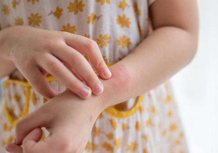 Трехлетняя россиянка подхватила кожную инфекцию во время отдыха в Азии