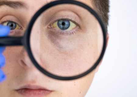 Нарколог предупредил о смертельной опасности алкоголя при гепатите С