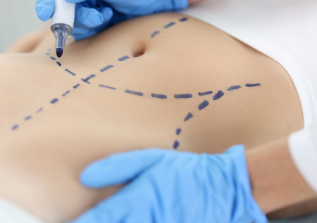 Россиянам объяснили, почему хирурги могут отказать в пластической операции