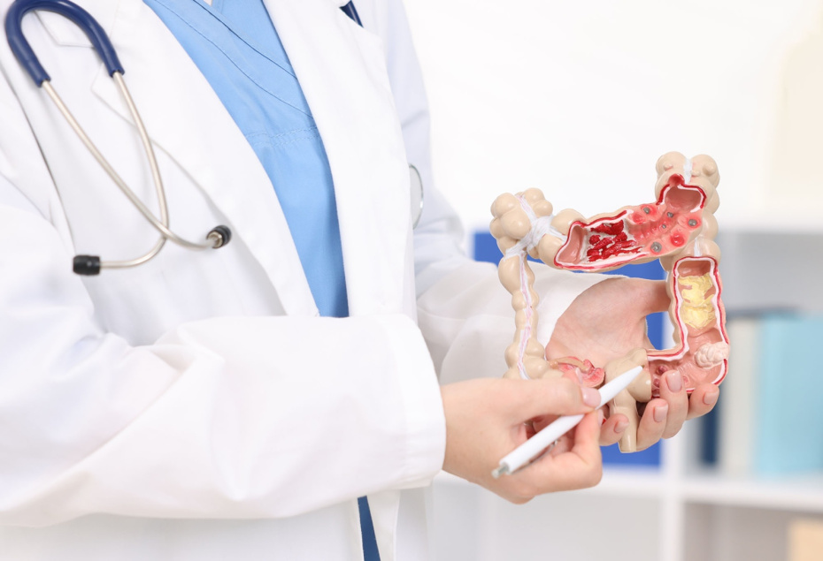 Как избежать разных видов рака: шесть жизненно важных советов онколога