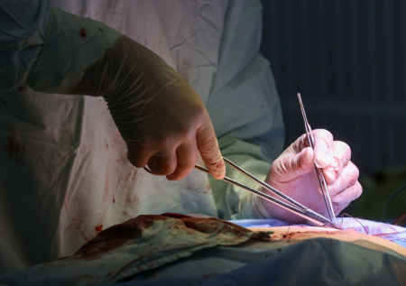 Врачи по частицам собрали череп россиянке