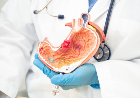 Назван способ узнать состояние желудка без гастроскопии