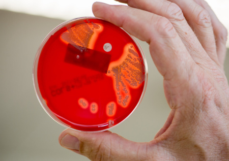 Когда появится российская вакцина от пневмококка