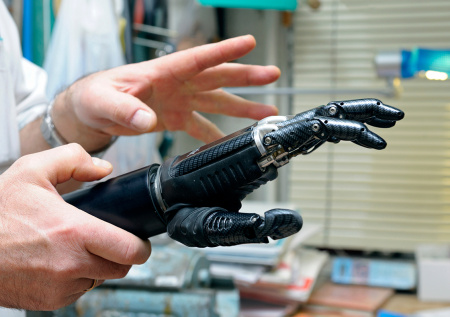 Пострадавшему при взрыве в Красногорске ребенку сделали уникальный протез