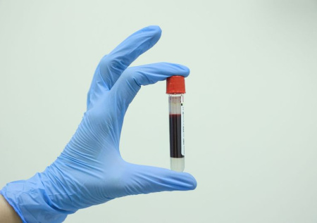 У российского спортсмена нашли следы допинга