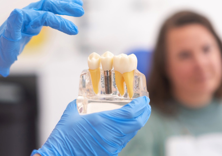 Стоматолог предупредила об осложнениях после имплантации зубов