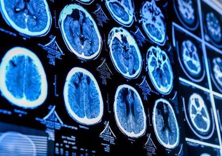 Новый модульный блок МРТ запустили в работу в Подмосковье