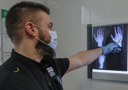 Травматолог рассказал, как отличить ушиб от перелома