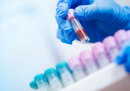 Онколог рассказала, какие анализы крови могут помочь обнаружить рак