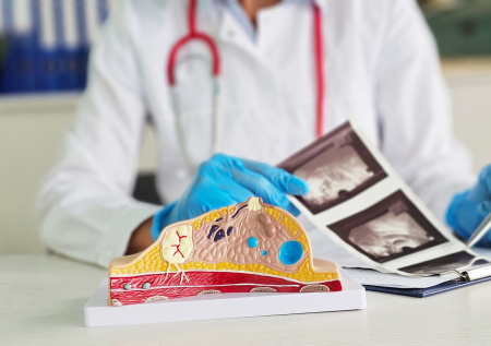 Онколог объяснила, как передается предрасположенность к развитию рака