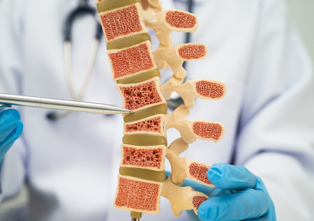 Врач предупредил о неочевидной привычке, незаметно портящей осанку