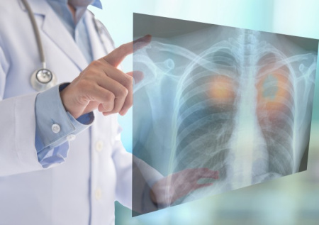 Россиянам назвали главный фактор развития ХОБЛ