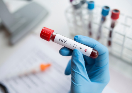 Минздрав ввел новые правила тестирования на ВИЧ