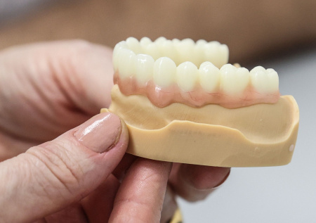 Стоматолог предостерег от покупки китайских виниров с маркетплейсов