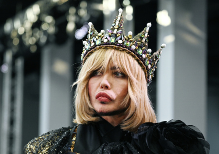 «Молодец!»: Зверев оценил изменения во внешности Собчак после пластики