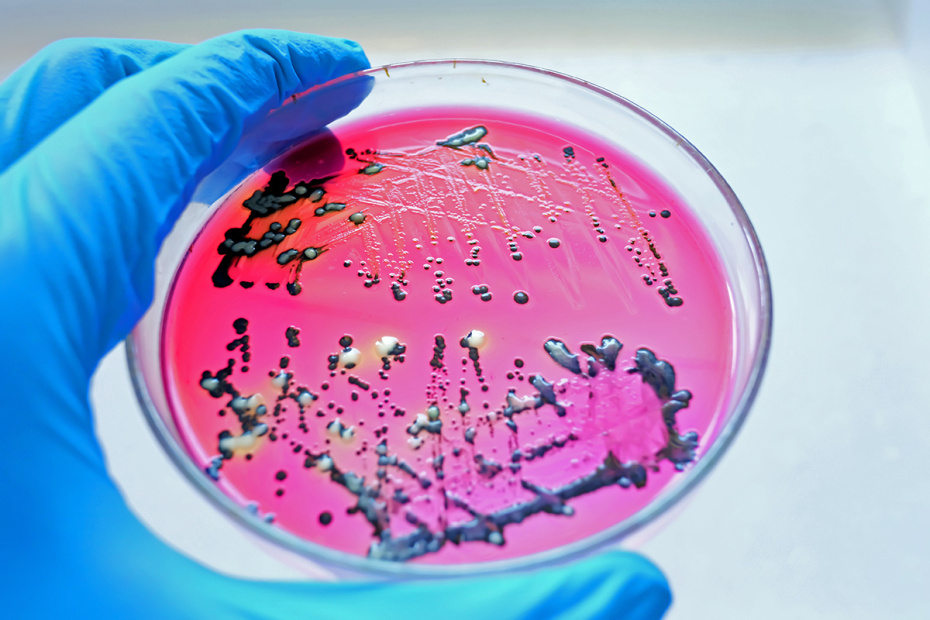 Колонии бактерий Salmonella