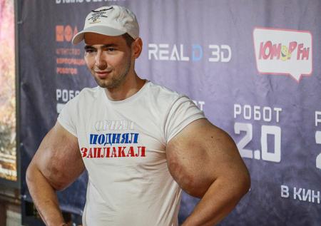 «Руки-базуки» показал синяки и шрамы
