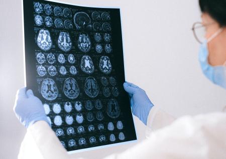 Нейробиологи назвали забывчивость признаком высокого интеллекта