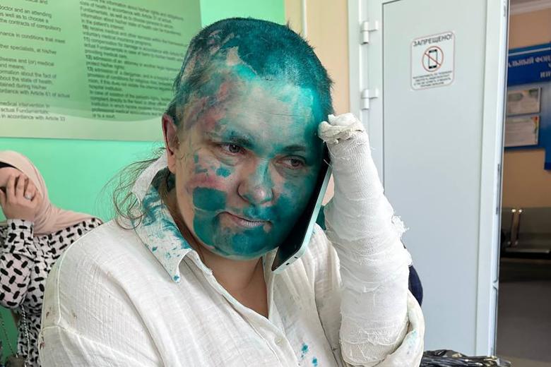 Журналистка Елена Милашина, подвергшаяся нападению со стороны неизвестных