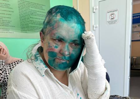 Журналистку Милашину выписали из больницы после нападения в Чечне