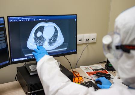 В США пациентка умерла после пересадки лёгких, заражённых COVID-19