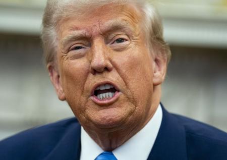 В Белом доме раскрыли, откуда у Трампа синяк на ладони