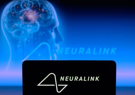 Первый обладатель чипа Neuralink раскрыл, как долго может им пользоваться