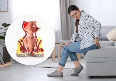 Спорт и геморрой: есть ли связь?