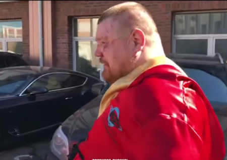 Опубликовано фото лица Дацика после боя с Тарасовым