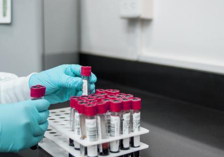 WADA отозвало аккредитацию Московской антидопинговой лаборатории