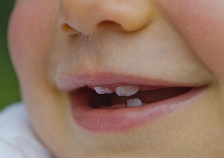 Родителям посоветовали не выбрасывать молочные зубы детей
