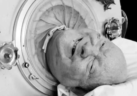 Умер Пол Александер, проживший в железном куполе 70 лет