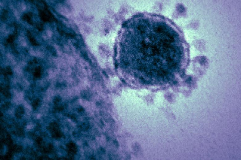 Микрофотография одного из видов коронавируса