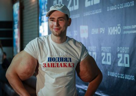 «Руки-базуки» готовится к операции по удалению знаменитых бицепсов