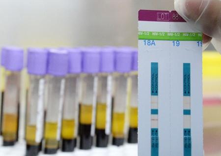 Распространение ВИЧ в РФ удалось остановить