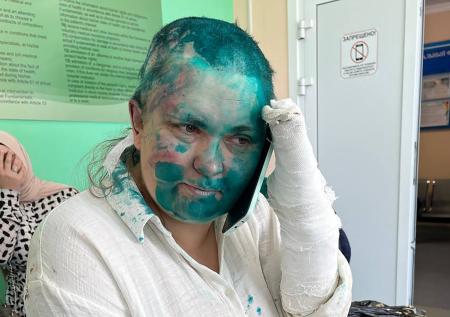 Милашина сообщила об угрозах расправой