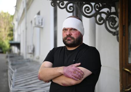 Поддубный сделал первое заявление после выписки из больницы