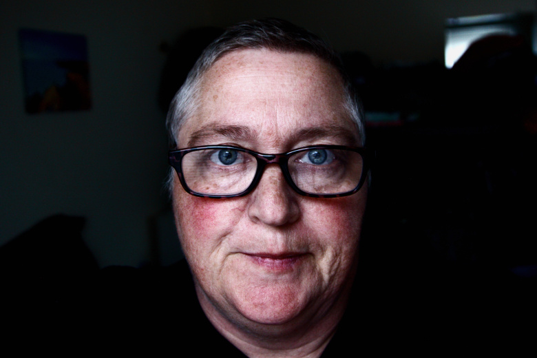 Cосудистое заболевание кожи —  купероз