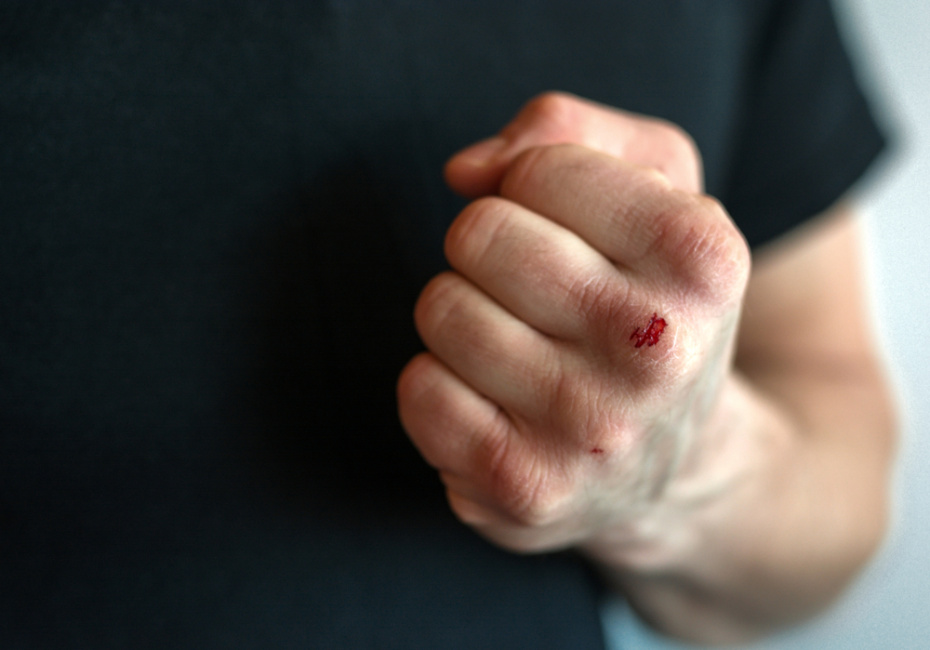 Труп в овраге с раскроенной челюстью: мигрант убил любовницу и сбежал из РФ