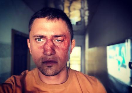 Избивший Прилучного бизнесмен рассказал о причинах драки