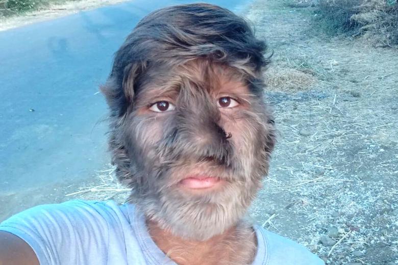 Лалиту Патидару